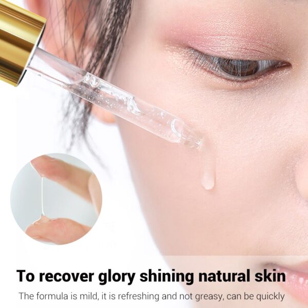 BREYLEE Acne Treatment Face Serum Mask Anti Acne Pimple Scar Remover Moisturizing Whitening Skin Care Facial Essence Cream 17ml - Image 4