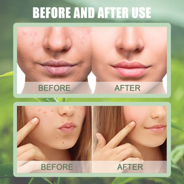 EELHOE Green Tea Solid Mask Deep Cleansing And Hydrating Mask Stick Shrinkage Of Pores Applicator Clay Mask - Image 5